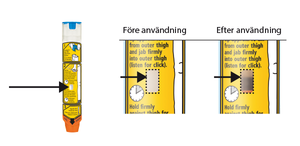 EpipEn